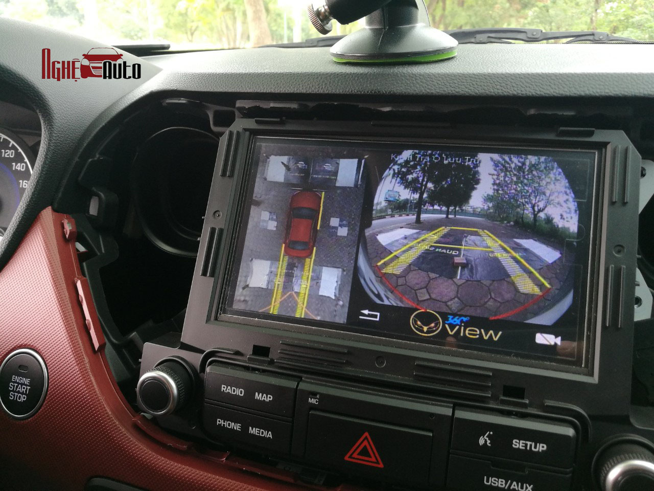Camera 360 Oview cho xe Hyundai i10